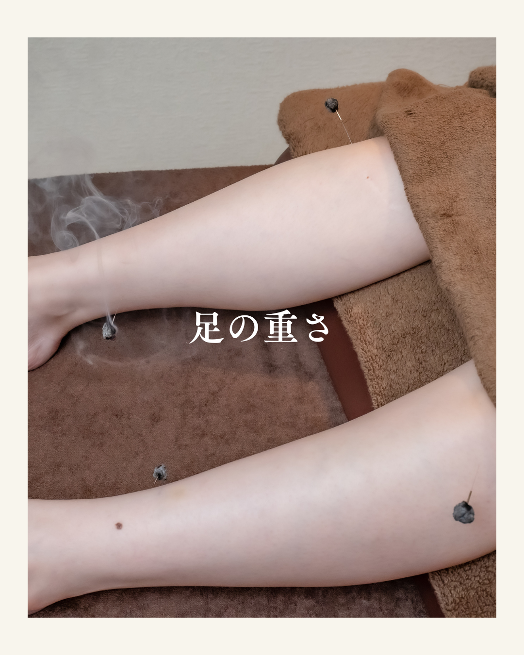 肋間神経痛の主な症状 (1)